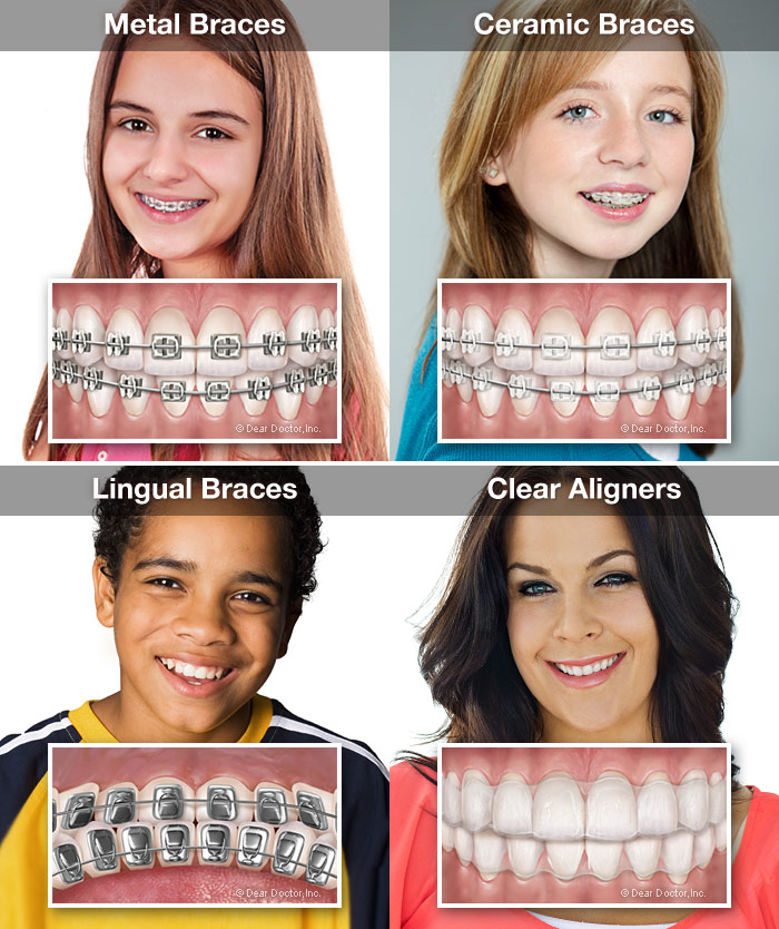 How Much Do Braces Cost?, Orthodontic Services